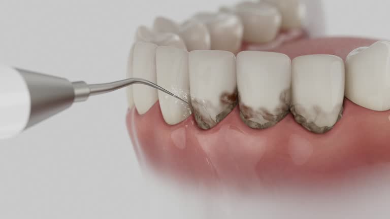 Trusted Dental Implants service in Kalamazoo, MI - Dentist Open Now